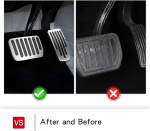 Pedaalhoes voor Tesla Model 3/Y