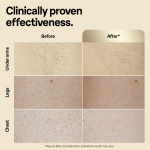 Braun IPL Silk-expert Pro 5 PL5242 IPL-apparaat Braun IPL Silk-expert Pro 5 PL5242 IPL-apparaat