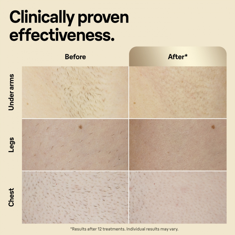 Braun IPL Silk-expert Pro 5 PL5242 IPL-apparaat Braun IPL Silk-expert Pro 5 PL5242 IPL-apparaat